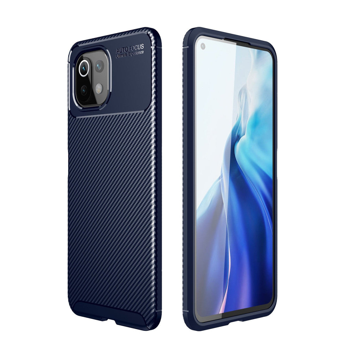 Newface Xiaomi Mİ 11 Lite Kılıf Auto Focus Karbon Kapak