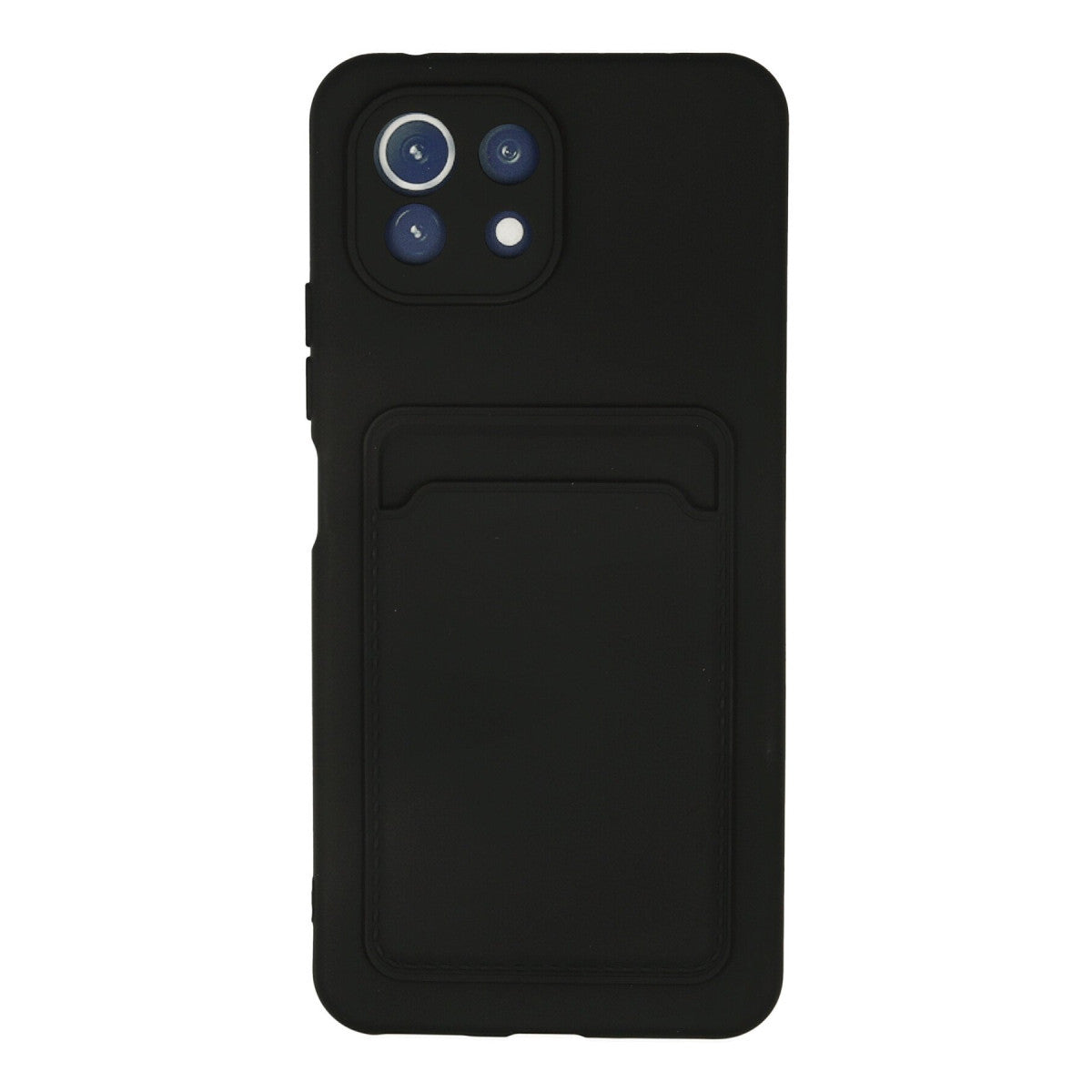 Newface Xiaomi Mİ 11 Lite Kılıf Kelvin Kartvizitli Silikon