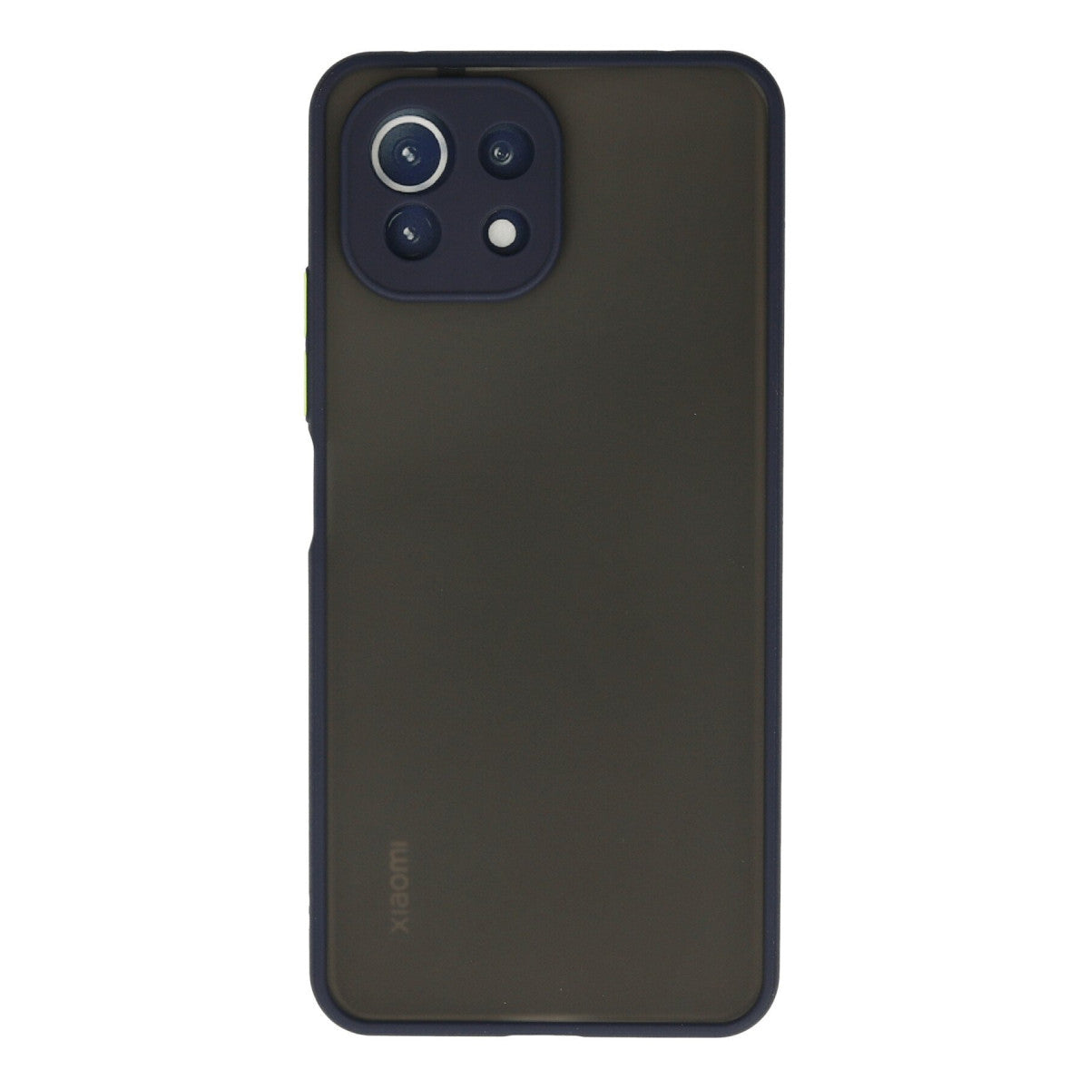 Newface Xiaomi Mİ 11 Lite Kılıf Montreal Silikon Kapak