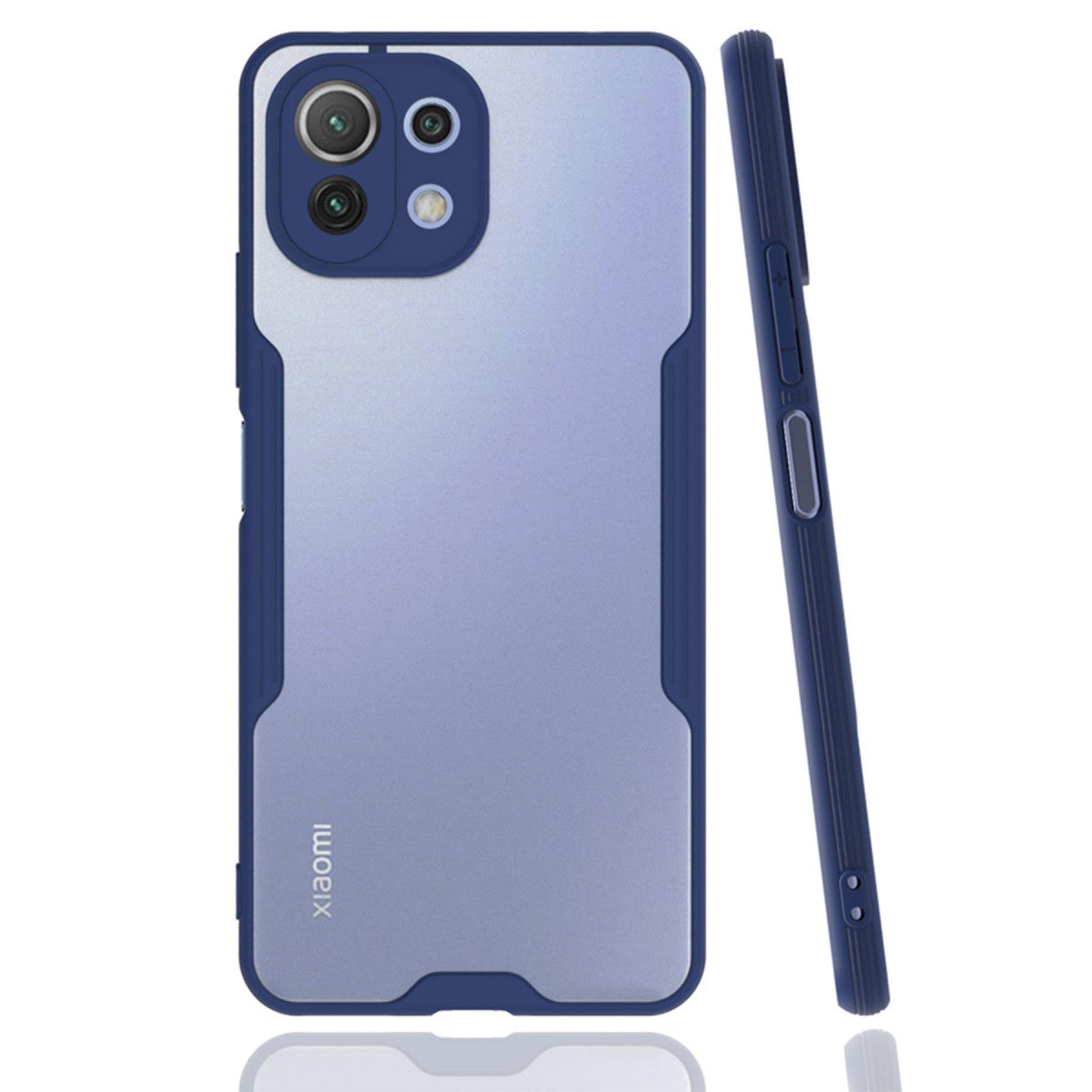 Newface Xiaomi Mİ 11 Lite Kılıf Platin Silikon