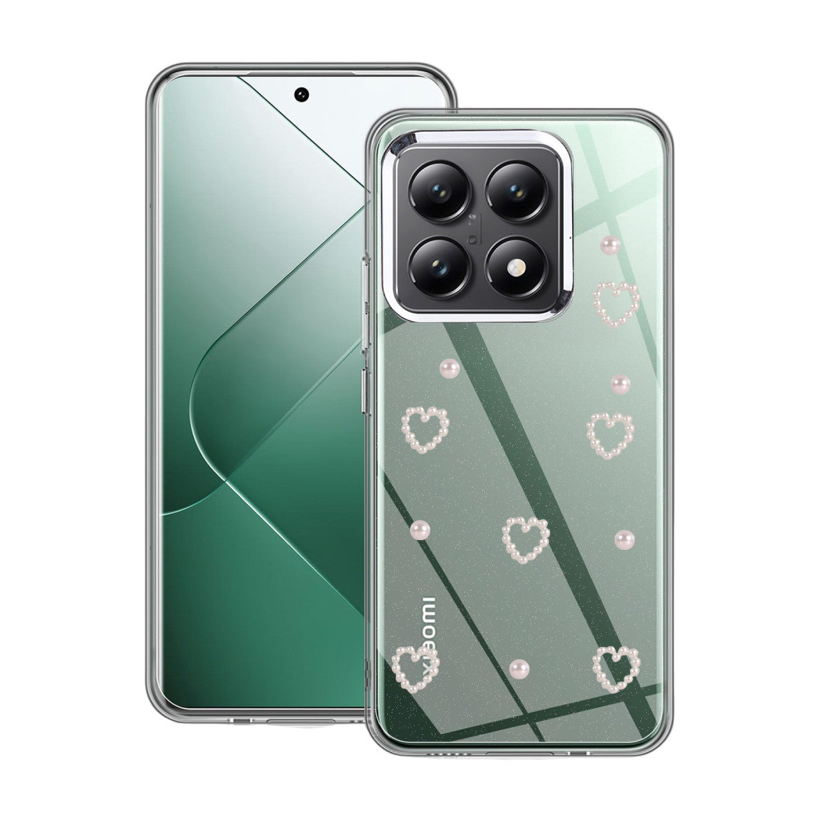 Newface Xiaomi Mi 14T Pro Fiyonk Desenli Kapak