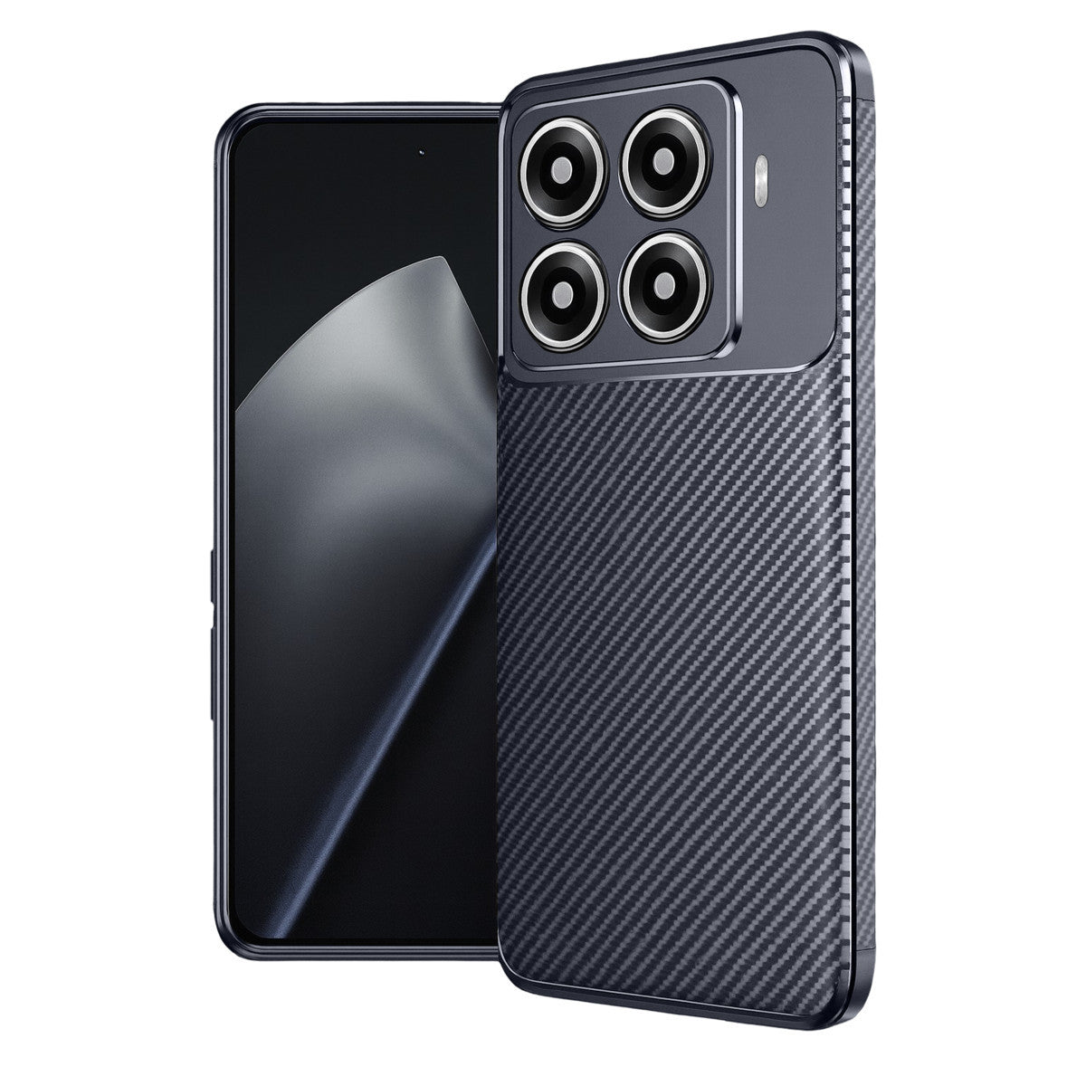 Newface Xiaomi Mi 15T Pro Auto Focus Karbon Kapak
