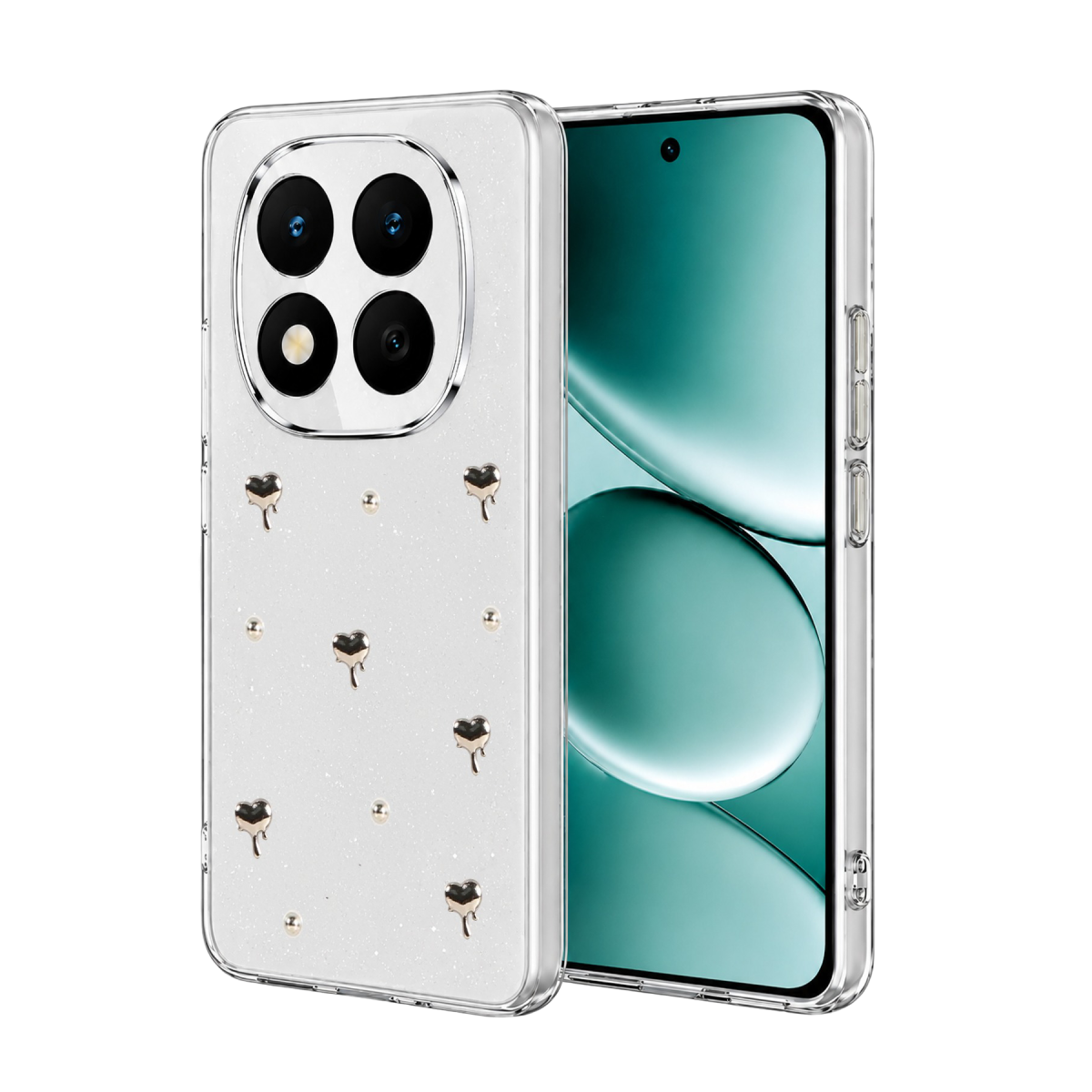 Newface Xiaomi Redmi Note 15 4G Fiyonk Desenli Kapak