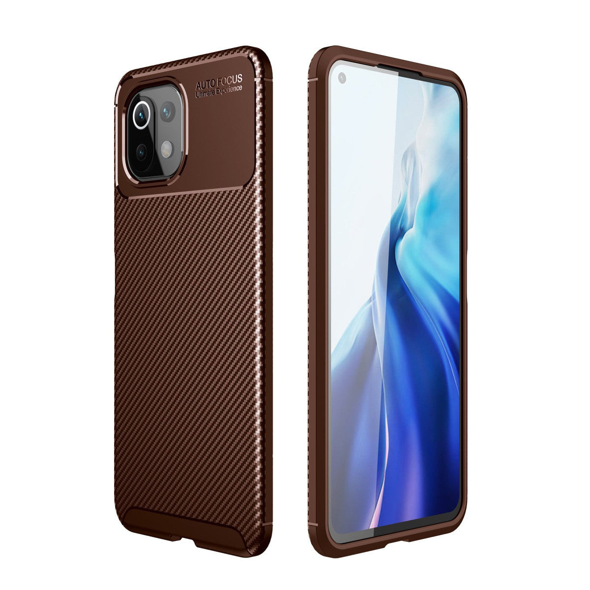Newface Xiaomi Mİ 11 Lite Kılıf Auto Focus Karbon Kapak