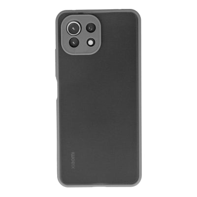 Newface Xiaomi Mİ 11 Lite Kılıf Montreal Silikon Kapak