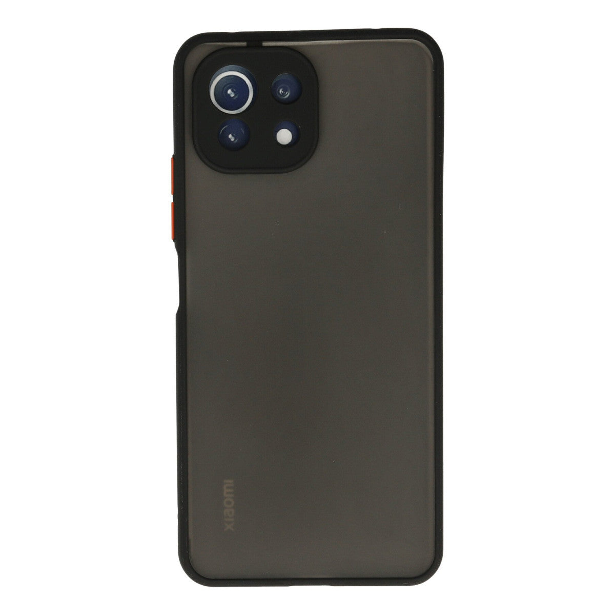 Newface Xiaomi Mİ 11 Lite Kılıf Montreal Silikon Kapak