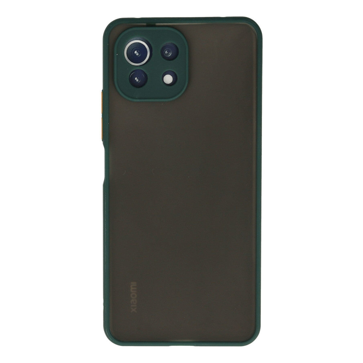 Newface Xiaomi Mİ 11 Lite Kılıf Montreal Silikon Kapak