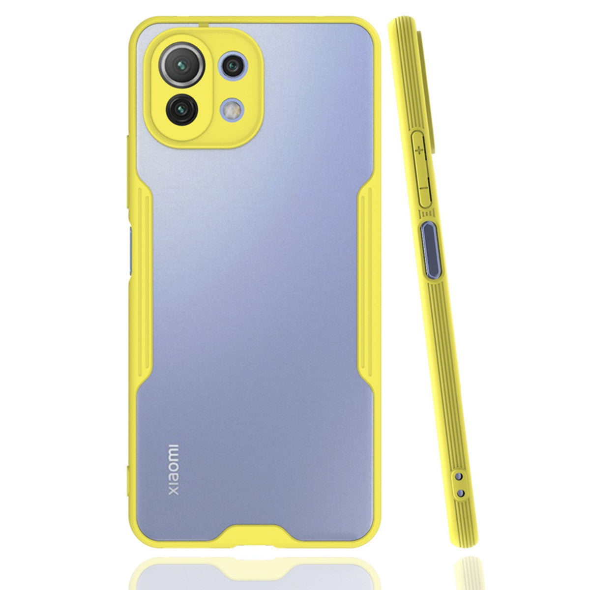 Newface Xiaomi Mİ 11 Lite Kılıf Platin Silikon
