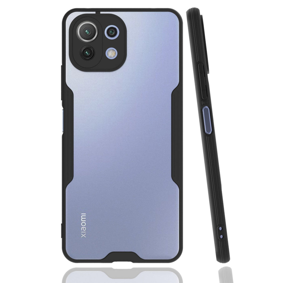 Newface Xiaomi Mİ 11 Lite Kılıf Platin Silikon