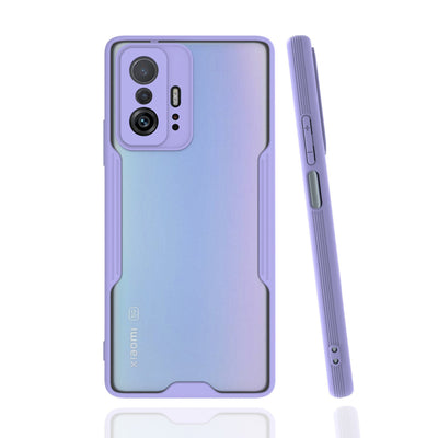 Newface Xiaomi Mi 11T Pro Kılıf Platin Silikon
