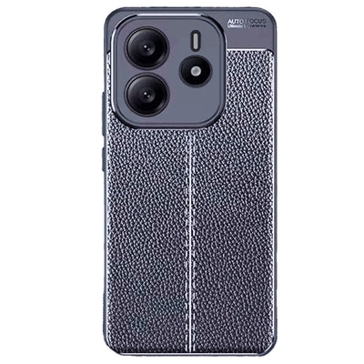 Newface Xiaomi Redmi Note 14 4G Kılıf Auto Focus Kapak