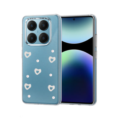 Newface Xiaomi Redmi Note 14 Pro 4G Fiyonk Desenli Kapak